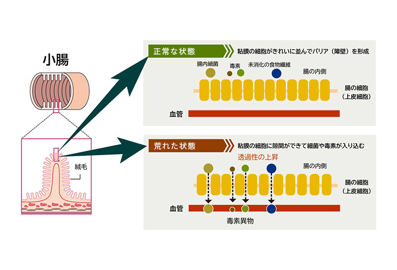 腸漏れ説明画像