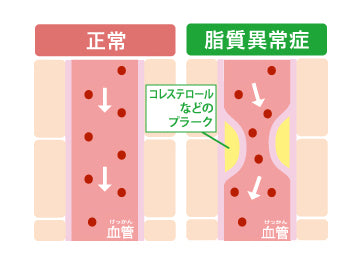 脂質を控える意義